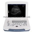 Mt Medical Hospital Portable Color Doppler Ultrasound